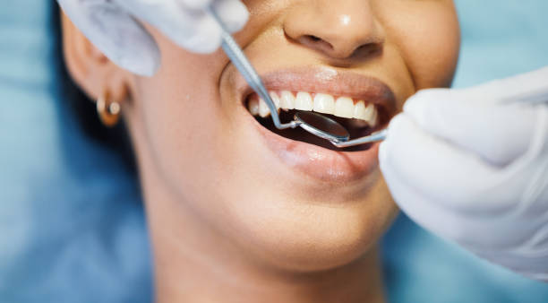 Best Emergency Tooth Extraction in Citrus Heights, CA
